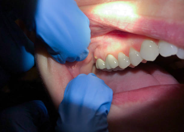 Best Emergency Treatment for Toothache in Glenwood, IL