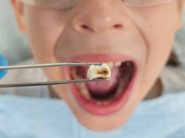 Best Weekend Emergency Dentist in Glenwood, IL